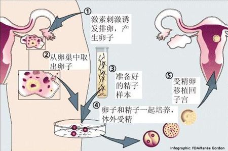 找卵代生子机构